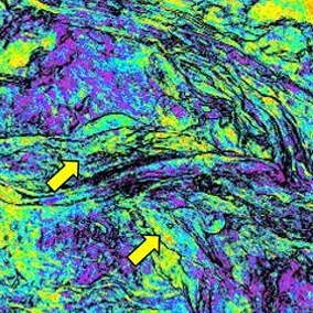 Blue and purple channels in map view.
