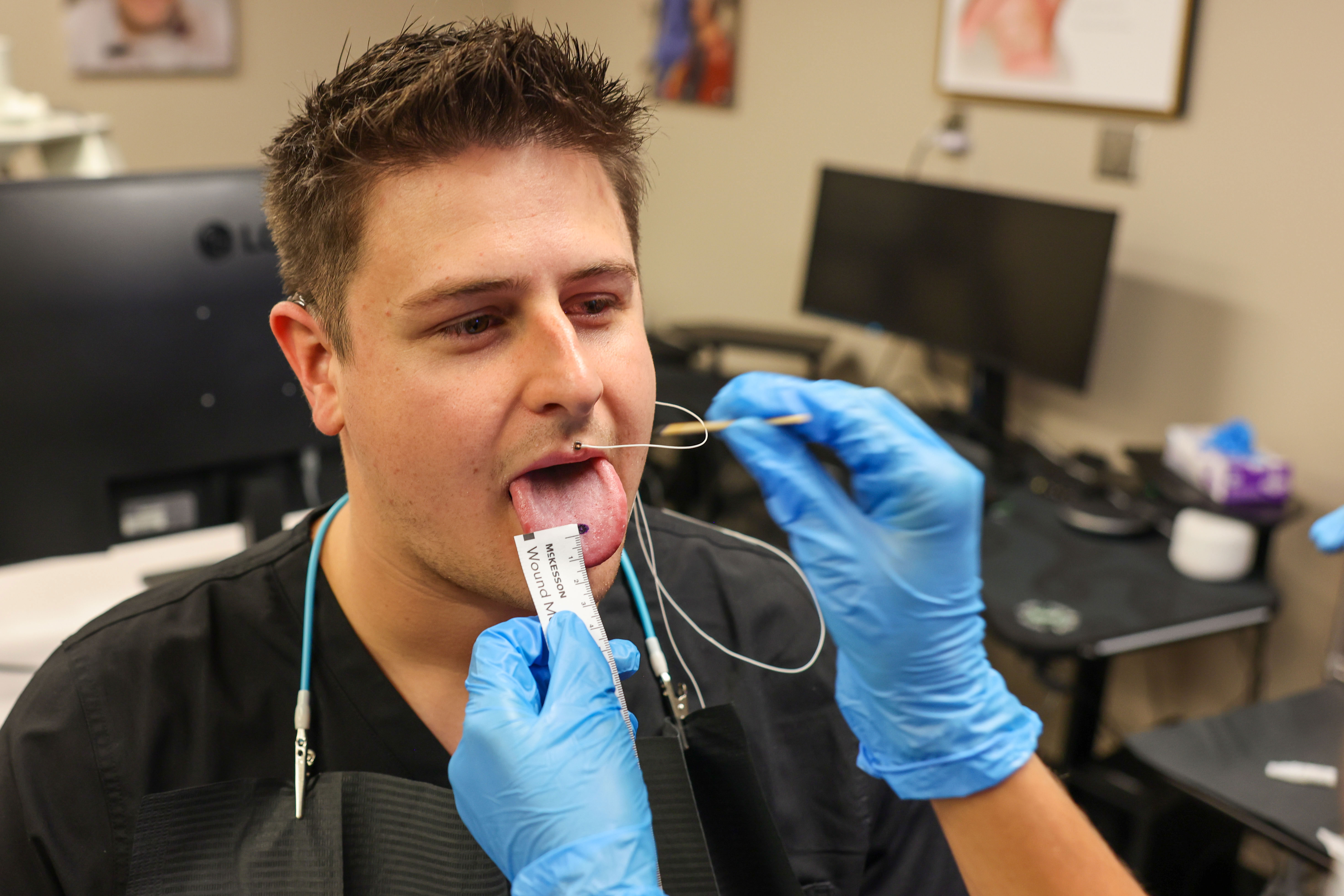 A man sticking his tongue out while a person wearing blue gloves puts a device on it. 