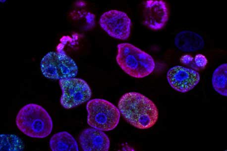 Microbes under an electron microscope