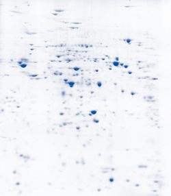 Drosophila Brain 2-D Gel image